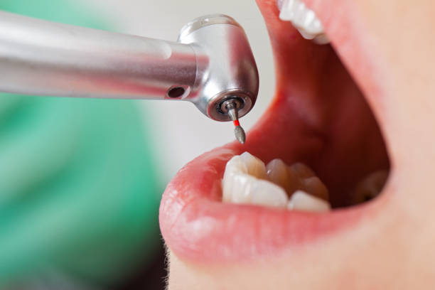 Best Pediatric Emergency Dentist in Al Creek, CO